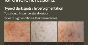 Vitamin C Hyaluronic Serum