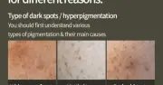 Vitamin C Hyaluronic Serum